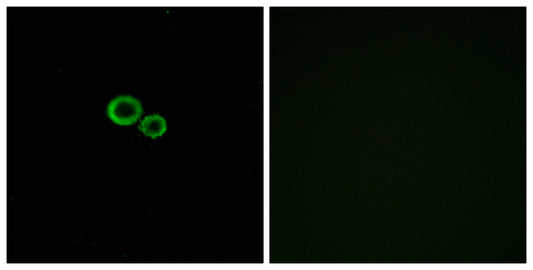 Olfactory receptor 11G2 Rabbit Polyclonal Antibody