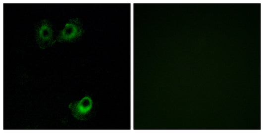 Olfactory receptor 11L1 Rabbit Polyclonal Antibody