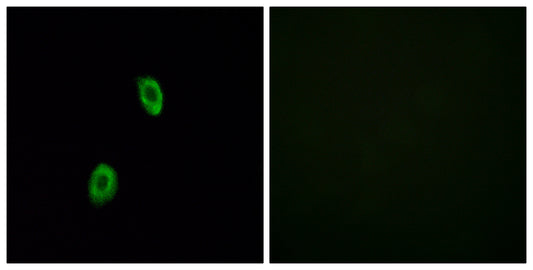 Olfactory receptor 1D2 Rabbit Polyclonal Antibody