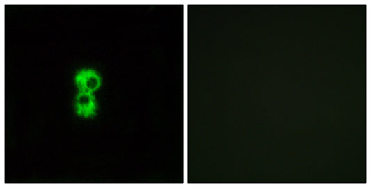 Olfactory receptor 1D4/1D5 Rabbit Polyclonal Antibody