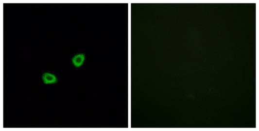 Olfactory receptor 1L6 Rabbit Polyclonal Antibody