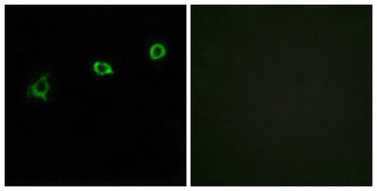Olfactory receptor 1N1 Rabbit Polyclonal Antibody