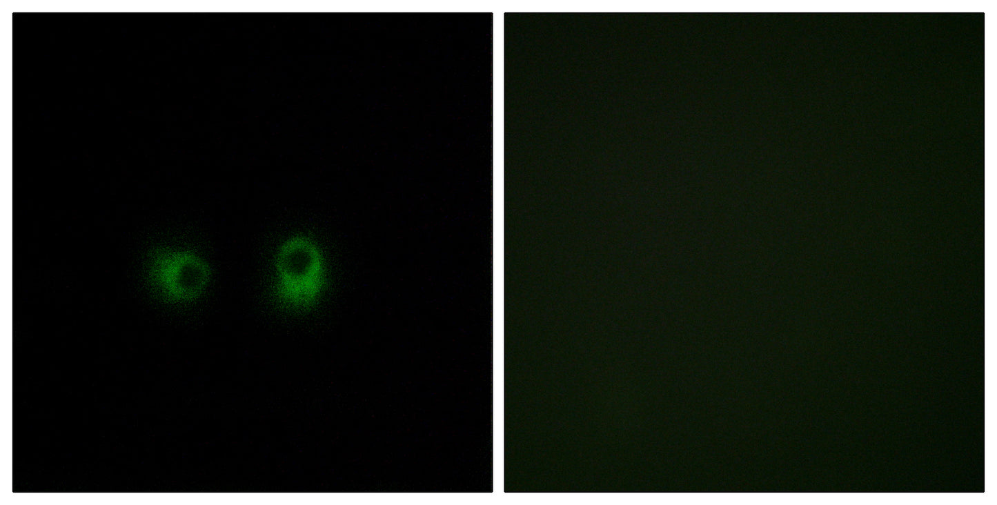 Olfactory receptor 2AK2 Rabbit Polyclonal Antibody