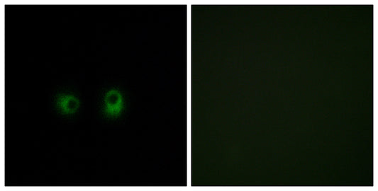 Olfactory receptor 2AK2 Rabbit Polyclonal Antibody
