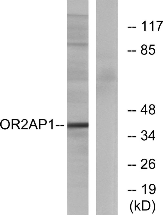 Olfactory receptor 2AP1 Rabbit Polyclonal Antibody