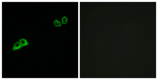 Olfactory receptor 2AT4 Rabbit Polyclonal Antibody