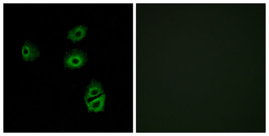 Olfactory receptor 2B2 Rabbit Polyclonal Antibody