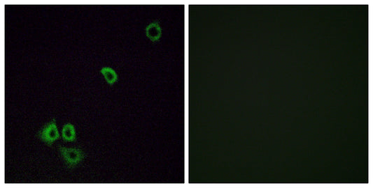 Olfactory receptor 2G3 Rabbit Polyclonal Antibody