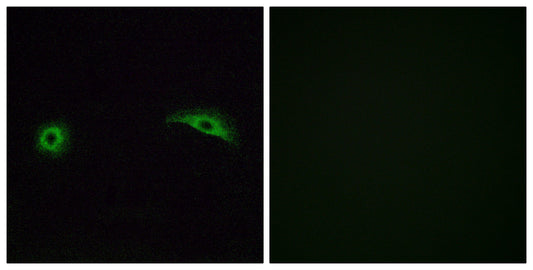 Olfactory receptor 2J2 Rabbit Polyclonal Antibody