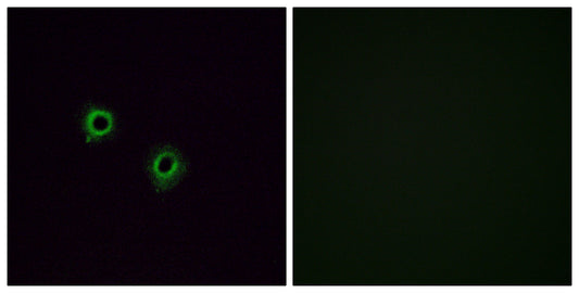 Olfactory receptor 2J3 Rabbit Polyclonal Antibody