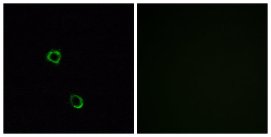 Olfactory receptor 2M2 Rabbit Polyclonal Antibody