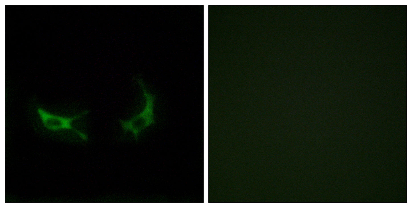 Olfactory receptor 2M3 Rabbit Polyclonal Antibody