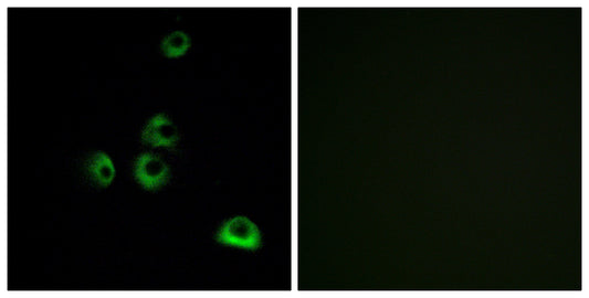 Olfactory receptor 2M7 Rabbit Polyclonal Antibody