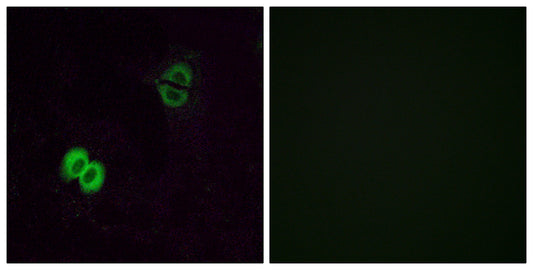 Olfactory receptor 2T1 Rabbit Polyclonal Antibody