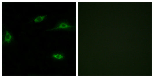 Olfactory receptor 2T11 Rabbit Polyclonal Antibody