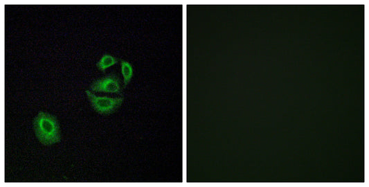 Olfactory receptor 2T2/35 Rabbit Polyclonal Antibody