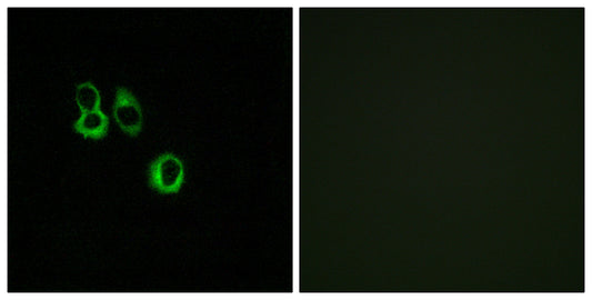 Olfactory receptor 3A2/3A3 Rabbit Polyclonal Antibody