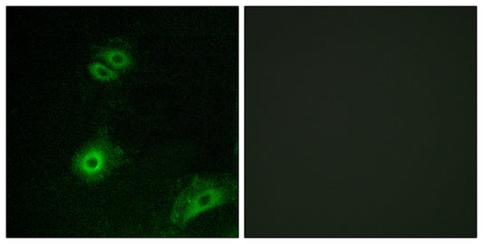 Olfactory receptor 4A16 Rabbit Polyclonal Antibody
