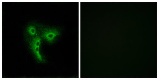 Olfactory receptor 4A4/47 Rabbit Polyclonal Antibody