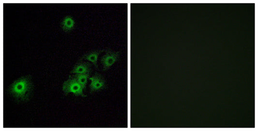 Olfactory receptor 4C15 Rabbit Polyclonal Antibody