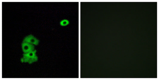 Olfactory receptor 4C6 Rabbit Polyclonal Antibody