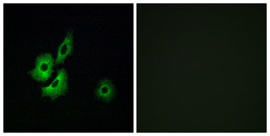 Olfactory receptor 4D1 Rabbit Polyclonal Antibody