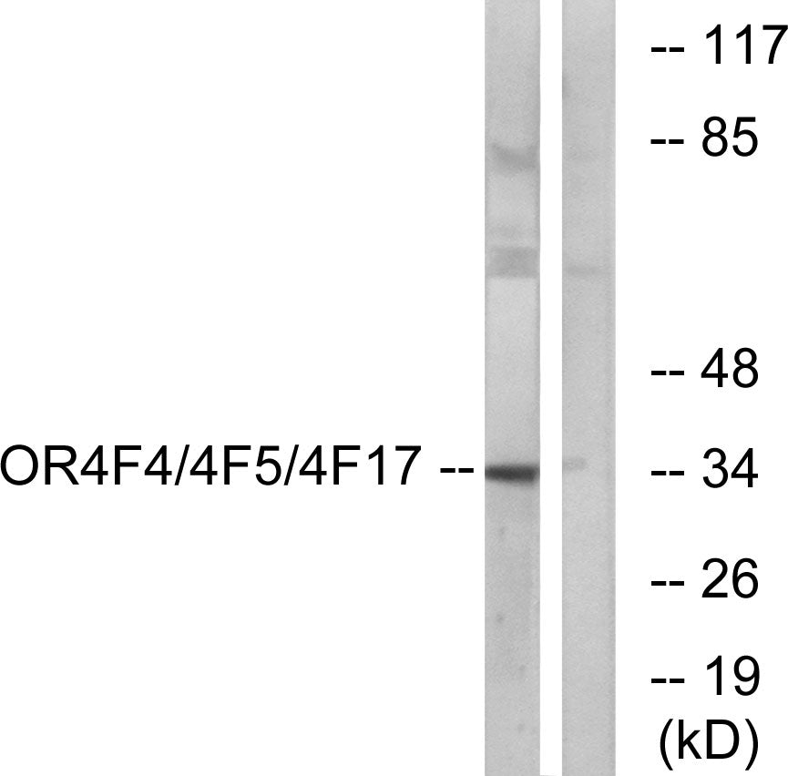 Olfactory receptor 4F4/4F5/4F17 Rabbit Polyclonal Antibody