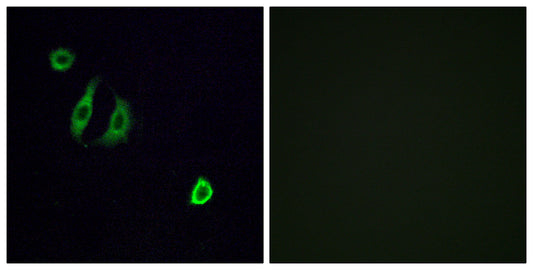 Olfactory receptor 4F6 Rabbit Polyclonal Antibody