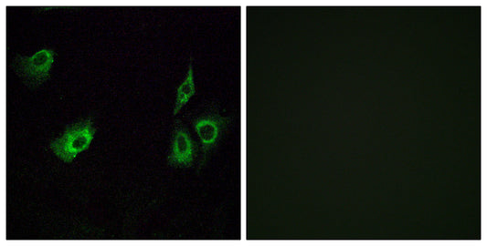 Olfactory receptor 4K3 Rabbit Polyclonal Antibody