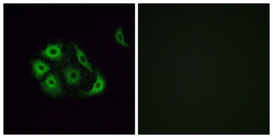 Olfactory receptor 4P4 Rabbit Polyclonal Antibody