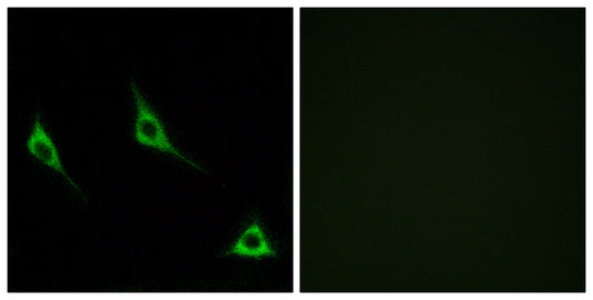 Olfactory receptor 51A7 Rabbit Polyclonal Antibody