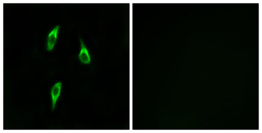Olfactory receptor 51B2 Rabbit Polyclonal Antibody