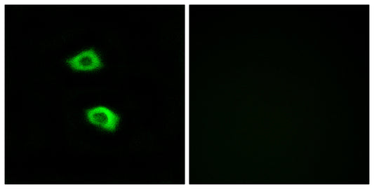 Olfactory receptor 51B5 Rabbit Polyclonal Antibody