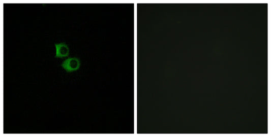 Olfactory receptor 51B6 Rabbit Polyclonal Antibody