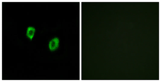 Olfactory receptor 51F1 Rabbit Polyclonal Antibody
