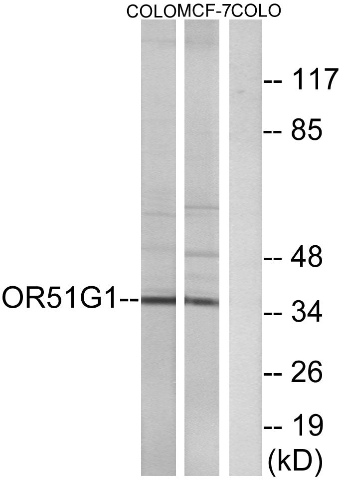 Olfactory receptor 51G1 Rabbit Polyclonal Antibody