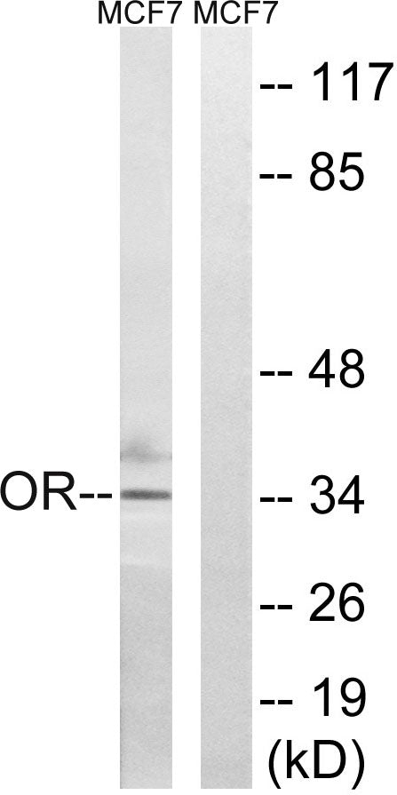Olfactory receptor 51H1 Rabbit Polyclonal Antibody