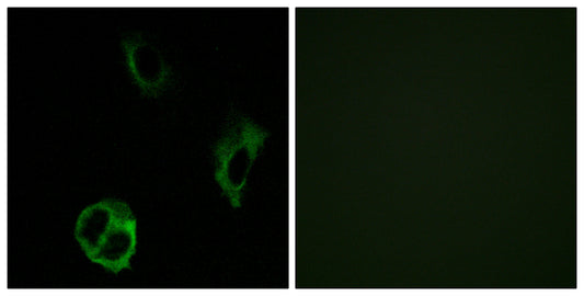 Olfactory receptor 51I1 Rabbit Polyclonal Antibody