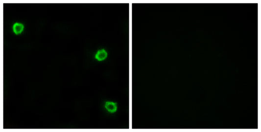 Olfactory receptor 51Q1 Rabbit Polyclonal Antibody