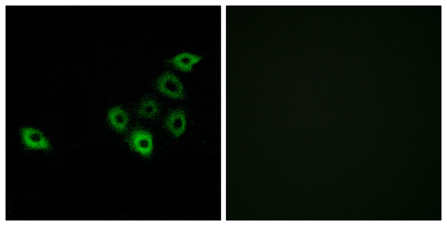Olfactory receptor 51S1 Rabbit Polyclonal Antibody