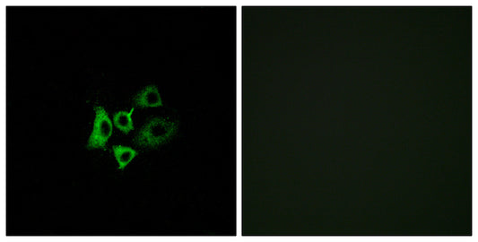 Olfactory receptor 51T1 Rabbit Polyclonal Antibody