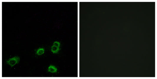 Olfactory receptor 52A1 Rabbit Polyclonal Antibody