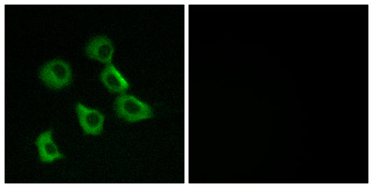Olfactory receptor 52B2 Rabbit Polyclonal Antibody