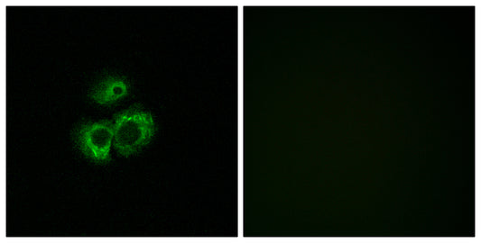 Olfactory receptor 52D1 Rabbit Polyclonal Antibody