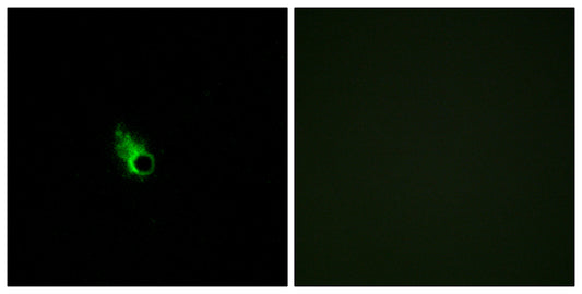 Olfactory receptor 52E1 Rabbit Polyclonal Antibody