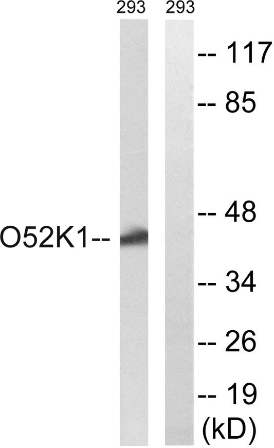 Olfactory receptor 52K1 Rabbit Polyclonal Antibody