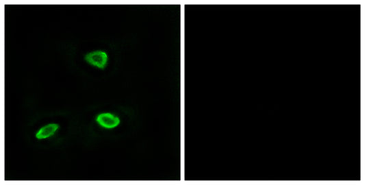 Olfactory receptor 52N1 Rabbit Polyclonal Antibody