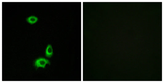 Olfactory receptor 56B1 Rabbit Polyclonal Antibody