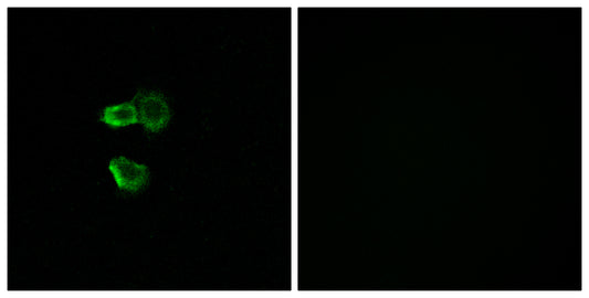 Olfactory receptor 56B4 Rabbit Polyclonal Antibody