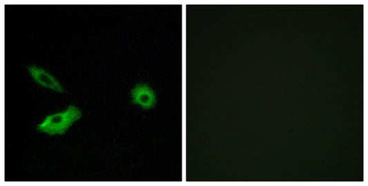Olfactory receptor 5AR1 Rabbit Polyclonal Antibody